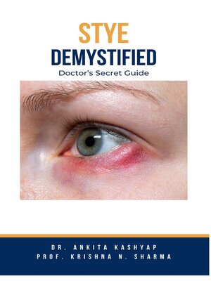 cover image of Stye Demystified